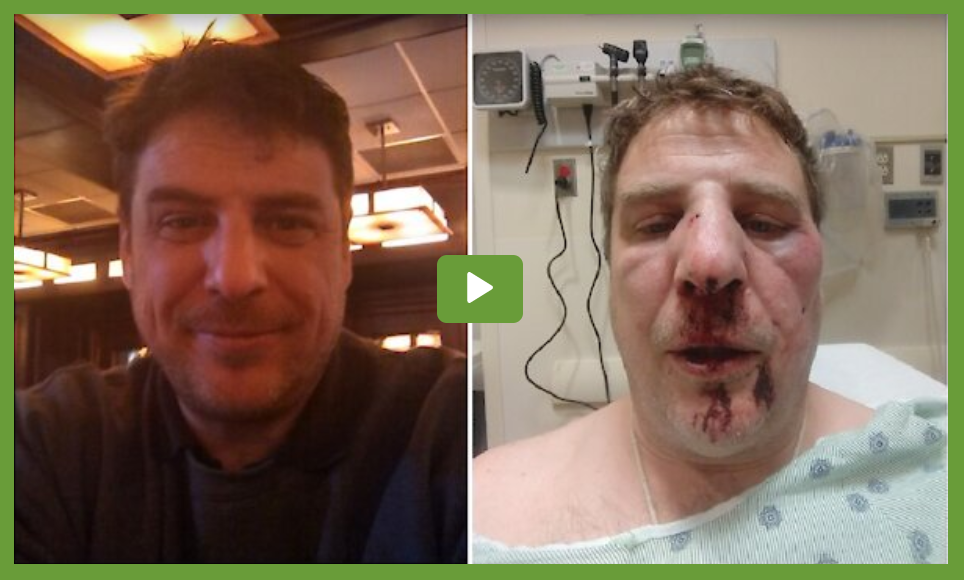 Matthew P. Kulesza with and without injuries.
